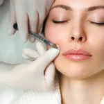 Exploring Dysport, Botox, and Juvederm for Youthful Radiance